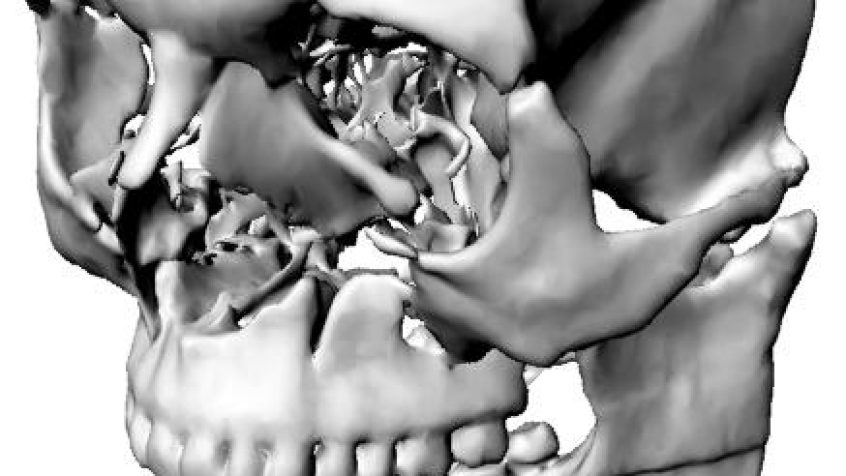 Model twarzoczaszki 3D