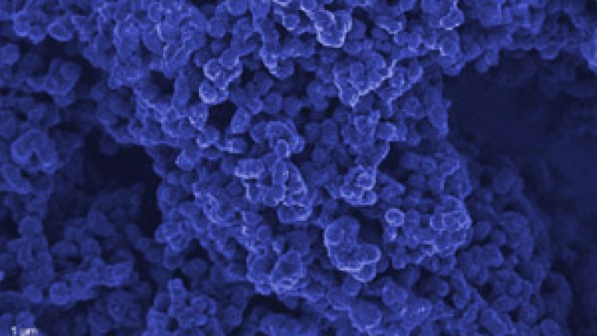 Nanostruktury węglowe ułatwią wykrycie Parkinsona